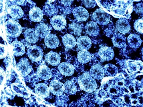 Đức phát hiện biến thể BA.2.86 của virus SARS-CoV-2